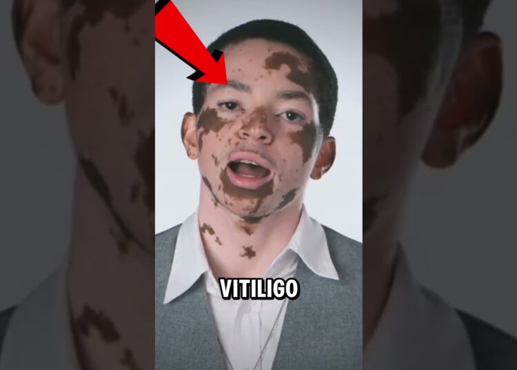 A verdadeira razão da luva do Michael Jackson…