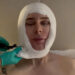 O maquiador de celebridades Kristofer Buckle conta como está se sentindo um ano após o lifting facial e o implante de queixo