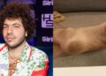 Pés e peidos de Benny Blanco chamam atenção online – Just Jared – Notícias e fofocas de celebridades