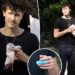 Shawn Mendes sofre ferimento com sangue na mão em fotos horríveis
