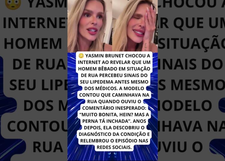 YASMIN BRUNET DIZ QUE MORADOR DE RUA PERCEBEU SEU LIPEDEMA ANTES DOS MÉDICOS!