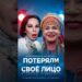 ПОТЕРЯЛИ СВОЁ ЛИЦО?! 5 российских звёзд, которых изуродовала пластика #знаменитости #знайобовсем