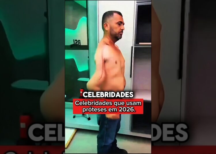 Celebridades que usam próteses em 2026. #brasil #celebridades #star