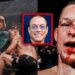 Lutadores Do UFC Que Brigaram De Verdade Com Celebridades