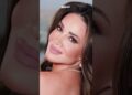 لن تعرف ديانا حداد بعد التجميل   أصبحت شخص آخر