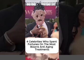 4 Celebrities Who Spent Fortunes on The Most Bizarre Anti Aging Treatments