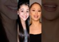 Celebrities before & after plastic surgery  #beforeandafter #celebrity #shorts