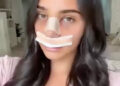 Antonia, 20, filha da estrela de 'RHONJ' Melissa Gorga, sofre reação após revelação de plástica no nariz: 'Makes Me Sad'