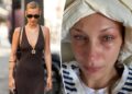 Bella Hadid compartilha a batalha do 'isolamento severo e da depressão' à medida que doenças crônicas surgem