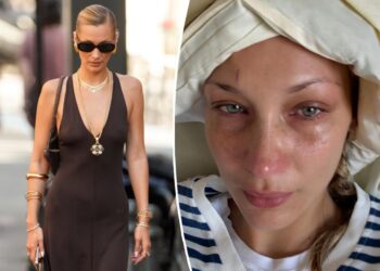 Bella Hadid compartilha a batalha do 'isolamento severo e da depressão' à medida que doenças crônicas surgem