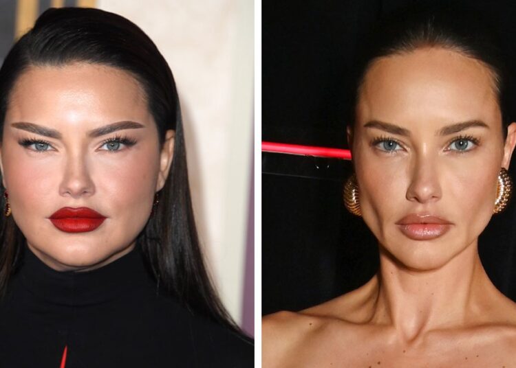“Ela fez remoção de gordura bucal”: 28 colagens de celebridades que expõem rumores de cirurgia plástica