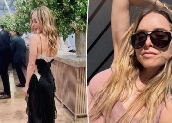 Jenny Mollen detalha os efeitos colaterais do 'filme de terror' da droga GLP-1: 'Sangue por toda parte'