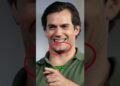 traços genéticos raros de celebridades #star #celebridades   #brasil