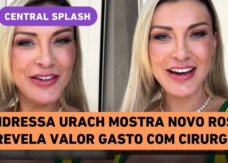 Exclusivo! Andressa Urach mostra novo rosto e dá palpite para o Jogo do Brasil contra a Noruega