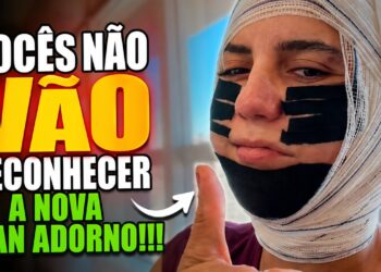 FRAN ADORNO, MEU DEUS, O QUE ACONTECEU?!?😱💉🧑🏻‍⚕️🩻
