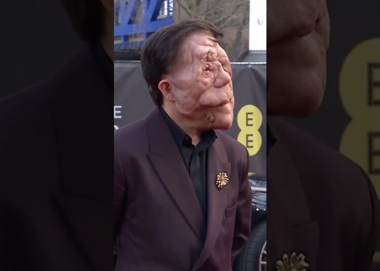 Estrellas que sobrevivieron a accidentes dignos de Destino Final.  #celebrity #famosos #hollywood