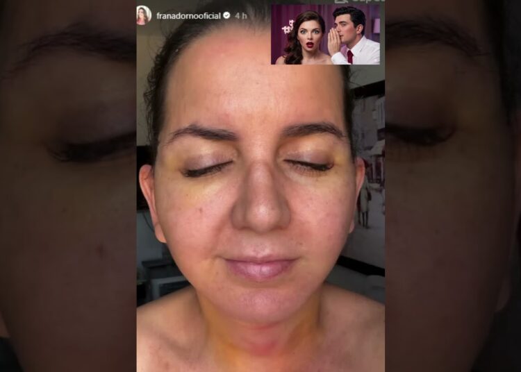 O NOVO ROSTO DE FRAN ADORNO!!! CHOCADO!!!💉😱😱