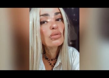Críticas às plásticas de Ruth Marlene chocam famosos: “Cada um faz aquilo que quer”