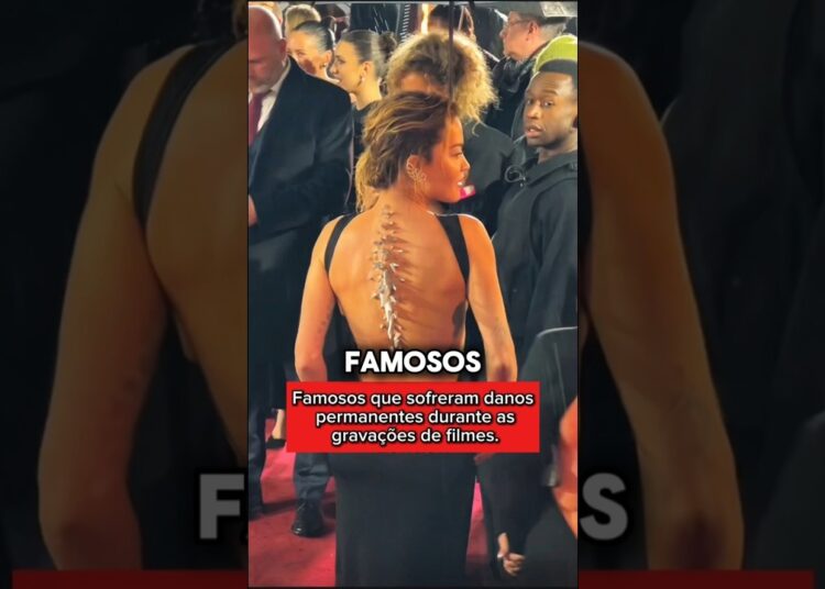Famosos que sofreram danos permanentes durante as gravações de filmes. #brasil #celebridades #star