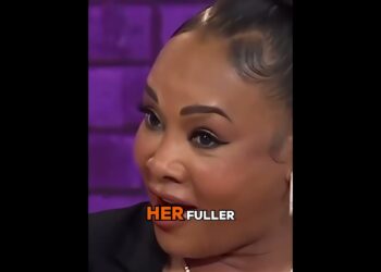 8 Hollywood Stars Whose Facelifts Went Too Far It’s Getting Worse P1#shorts #actor #longervideos