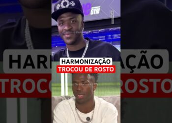 Vini Jr passou por harmonização facial e surgiu com o rosto transformado.