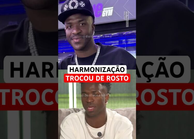 Vini Jr passou por harmonização facial e surgiu com o rosto transformado.