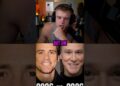 Joe Bart Reacts To Worst Hollywood Surgerys 💉