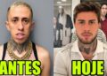 9 FAMOSOS QUE FIZERAM HARMONIZAÇÃO FACIAL e SE TORNARAM OUTRA PESSOA #27