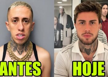 9 FAMOSOS QUE FIZERAM HARMONIZAÇÃO FACIAL e SE TORNARAM OUTRA PESSOA #27