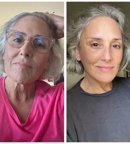 Ricki Lake, 57, compartilha fotos inéditas de antes e depois de um facelift dramático em uma atualização de dois anos