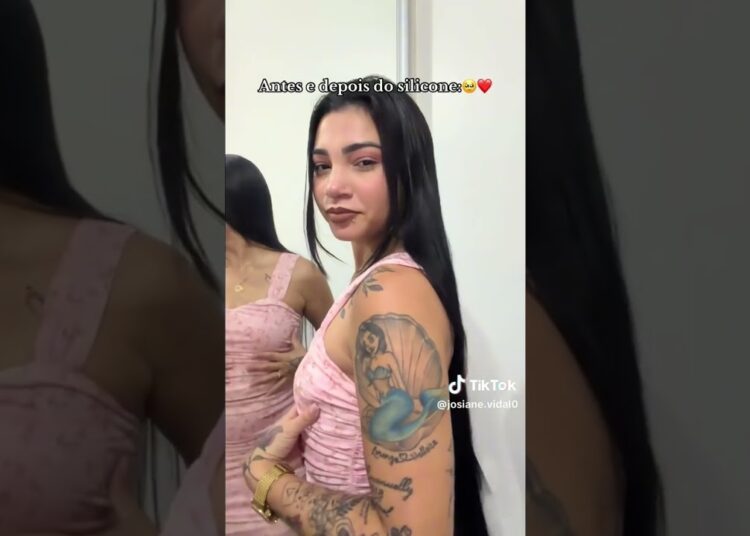 Ante se depois de Josiane Vidal após cirurgia plástica #polemica#noticias #fofoca #josierizal