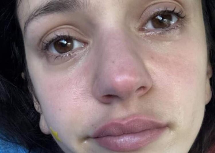 Sobrecogedora e impactante imagen de Rosalía, con lágrimas en los ojos: qué le ha pasado