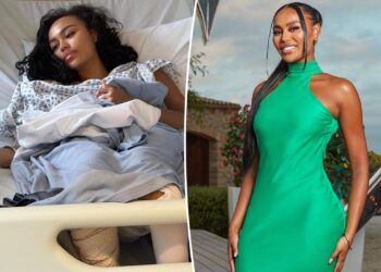 La estrella de 'Love Island UK' Ella Thomas hospitalizada para una cirugía de emergencia después de un extraño accidente