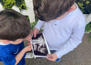 Los dos hijos de la pareja, August, 5, y Ernest, 2, observan la exploración del embarazo de su hermano menor.