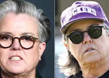Rosie O'Donnell Says She Had Surgery That Cost More Than She Paid For A Car