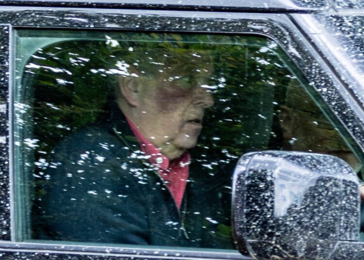 Andrew Mountbatten-Windsor conduciendo un Land Rover, con una prominente marca roja en la mejilla.