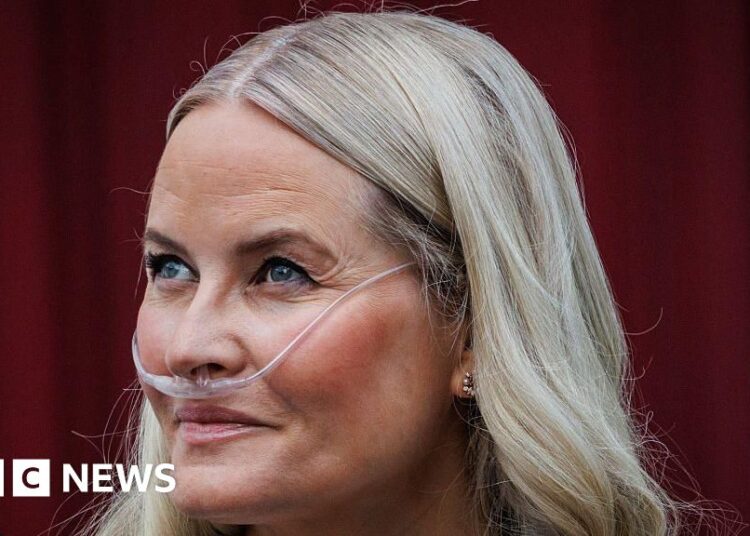 La princesa heredera de Noruega se somete con éxito a un trasplante de pulmón, dice palacio