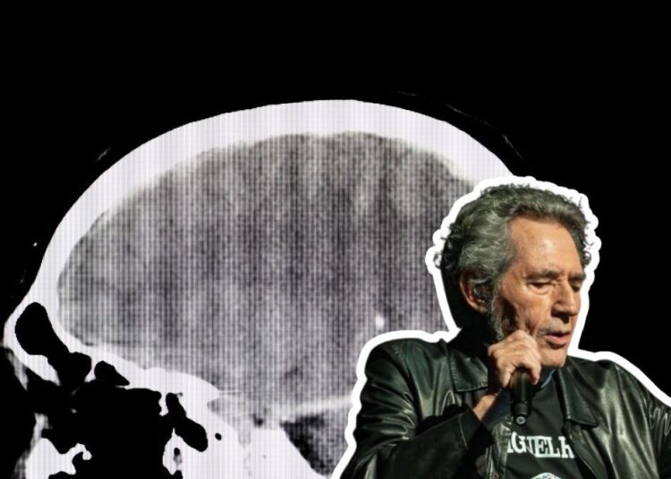 ¿Qué le pasó a Miguel Ríos? Cantante sufre traumatismo craneal y cancela conciertos